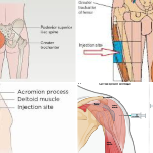 ⁠Intramuscular Injection Techniques